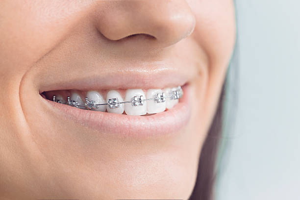 Best Veneers and Lumineers  in Terrace Park, OH